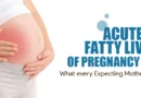 Acute Fatty Liver of Pregnancy (AFLP): What Every Expecting Mother Should Know