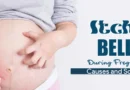 Itchy Belly During Pregnancy: Causes and Solutions