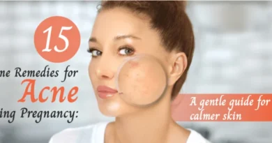 15 ‍‌Safe Home Remedies for Acne During Pregnancy: A Gentle Guide for Clearer, Calmer Skin
